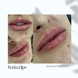 Aesthetic medicine doctors | Dr. Giorgos Vasiliou