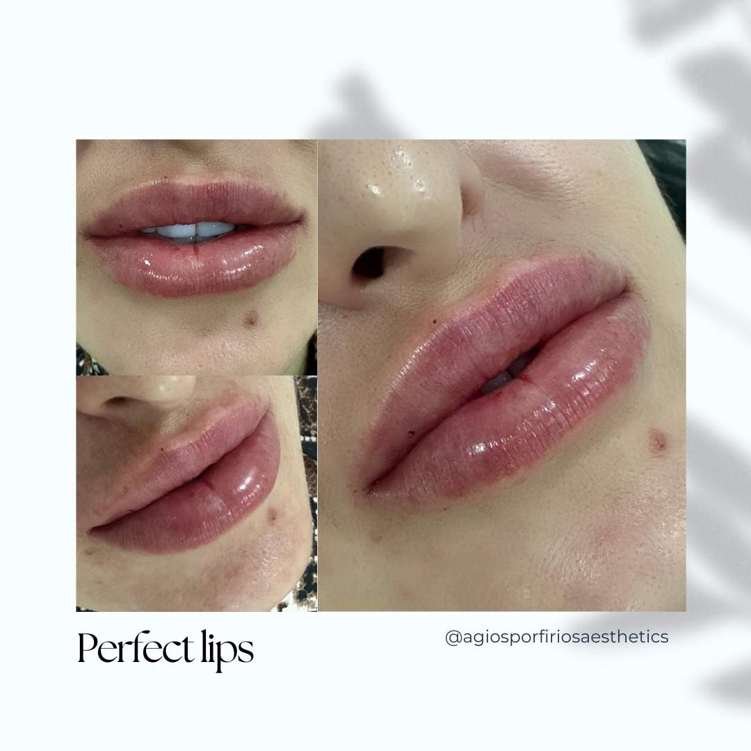 Aesthetic medicine doctors | Dr. Giorgos Vasiliou