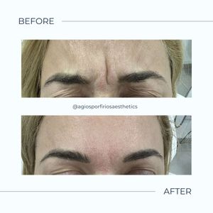 Aesthetic medicine doctors | Dr. Giorgos Vasiliou