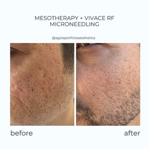 Aesthetic medicine doctors | Dr. Giorgos Vasiliou