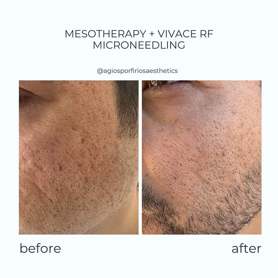 Aesthetic medicine doctors | Dr. Giorgos Vasiliou