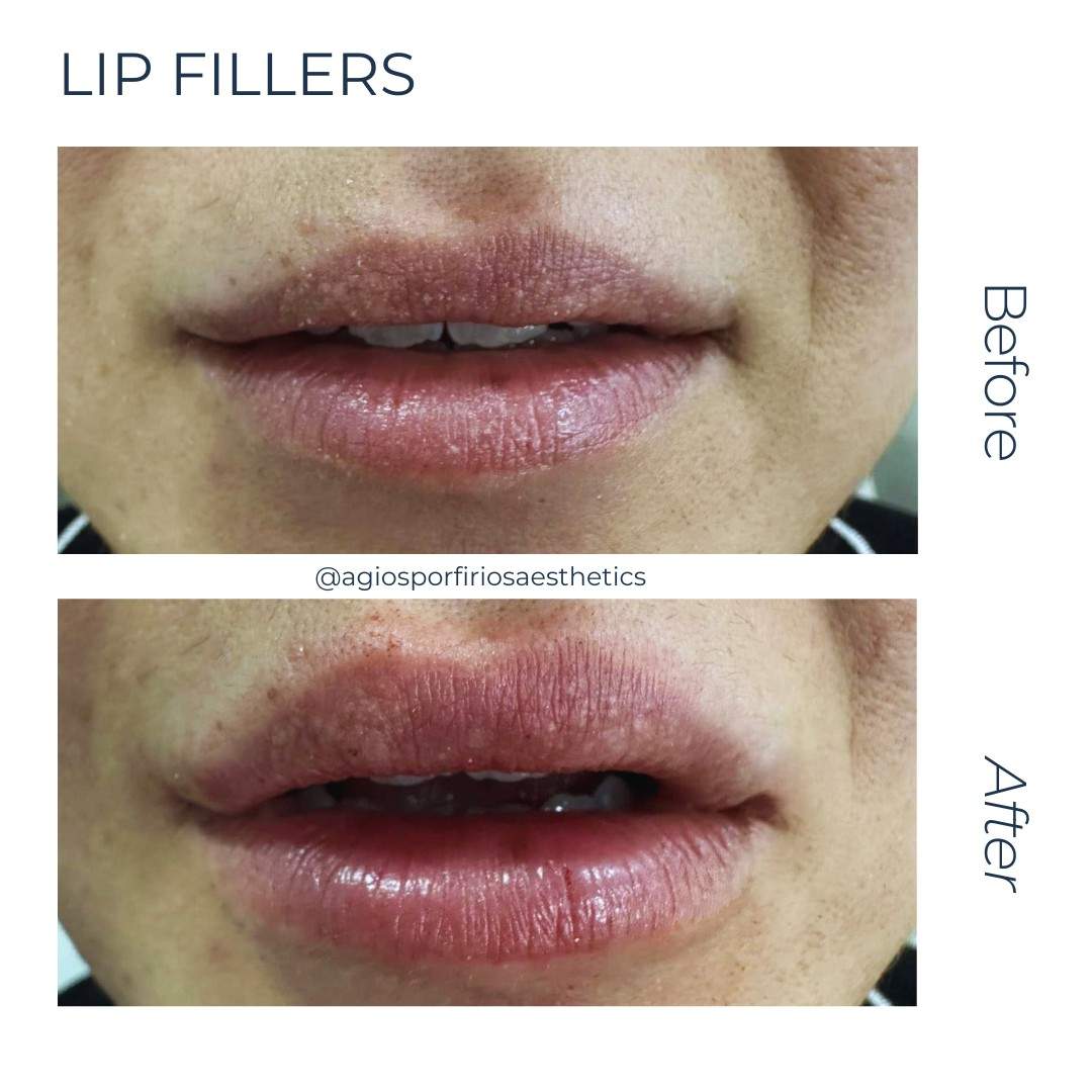 Aesthetic medicine doctors | Dr. Giorgos Vasiliou