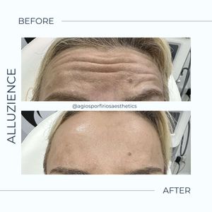 Aesthetic medicine doctors | Dr. Giorgos Vasiliou