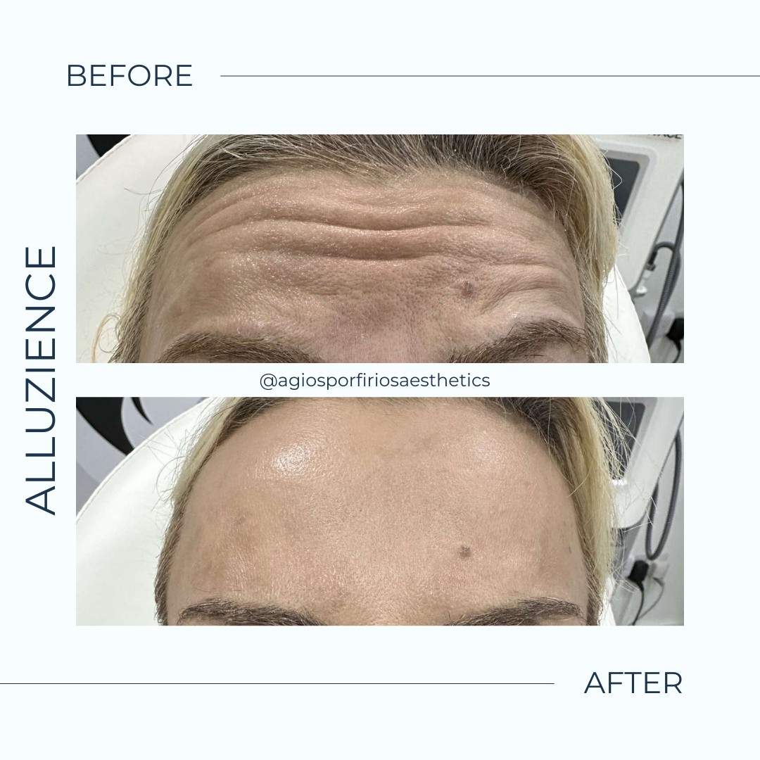 Aesthetic medicine doctors | Dr. Giorgos Vasiliou