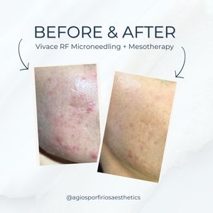 Aesthetic medicine doctors | Dr. Giorgos Vasiliou