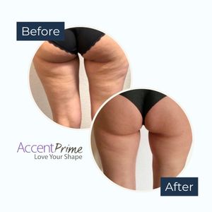 Aesthetic medicine doctors | Dr. Giorgos Vasiliou