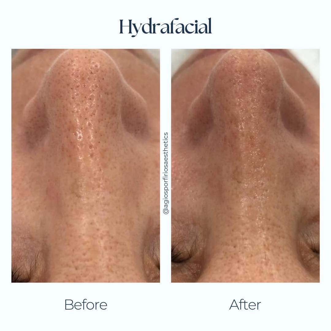 Aesthetic medicine doctors | Dr. Giorgos Vasiliou